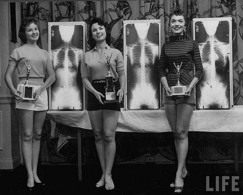 winning-models-marianne-baba-l-lois-conway-c-and-ruth-swensen-standing-next-to-plates-of-their-x-ray-during-a-chiropractor-beauty-contest-via-grungegeekdes